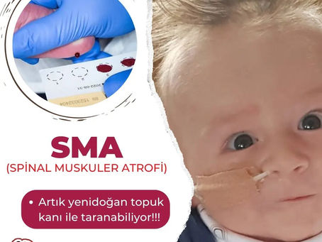 Spinal Müsküler Atrofi (SMA)