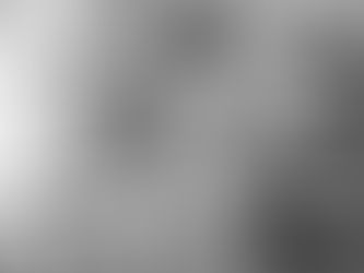 10-ամյա աղջիկը, արդեն 8 օր է, կոմայի մեջ է, ծնողներն էլ վթարից հետո հիվանդանոցից դուրս են գրվել․ ի՞նչ է հայտնի