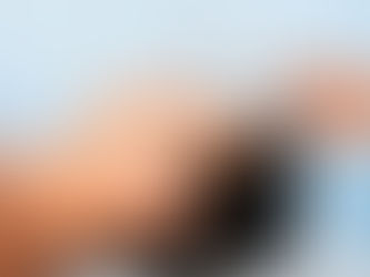 Դեմքի պլաստիկ վիրահատություն․ Ո՞ւմ է հակացուցված