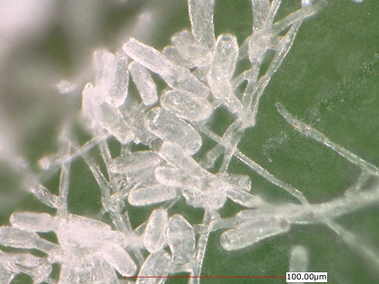 牡丹のうどん粉病 みろくぱわー.webp