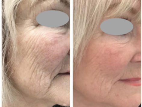 Dermafocus_edited.jpg