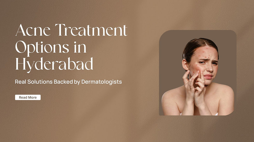 Acne Treatment Options in Hyderabad