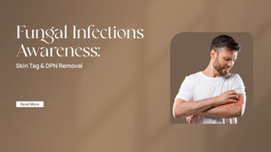 Fungal Infections Awareness