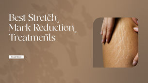 Best Stretch Mark Reduction Treatments