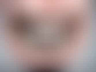 Full Arch Conversion Services: Implant Tech Specialist Dental Laboratory