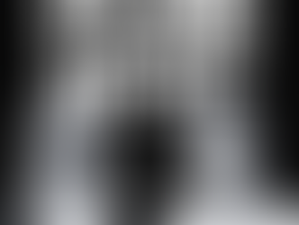 Why Anaplan Projects Take Longer Than Expected