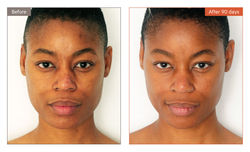 Bend_BeforeandAfters_Valerie