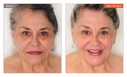 Bend_BeforeandAfters_Joey