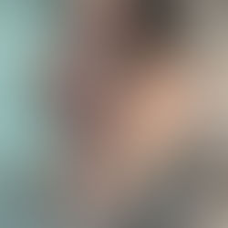 Smiling Hurts Here Too: Ty Hafan