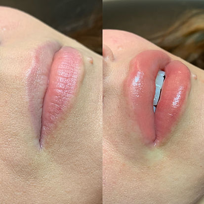 Lip blush tattoo treatment before and after Brighton