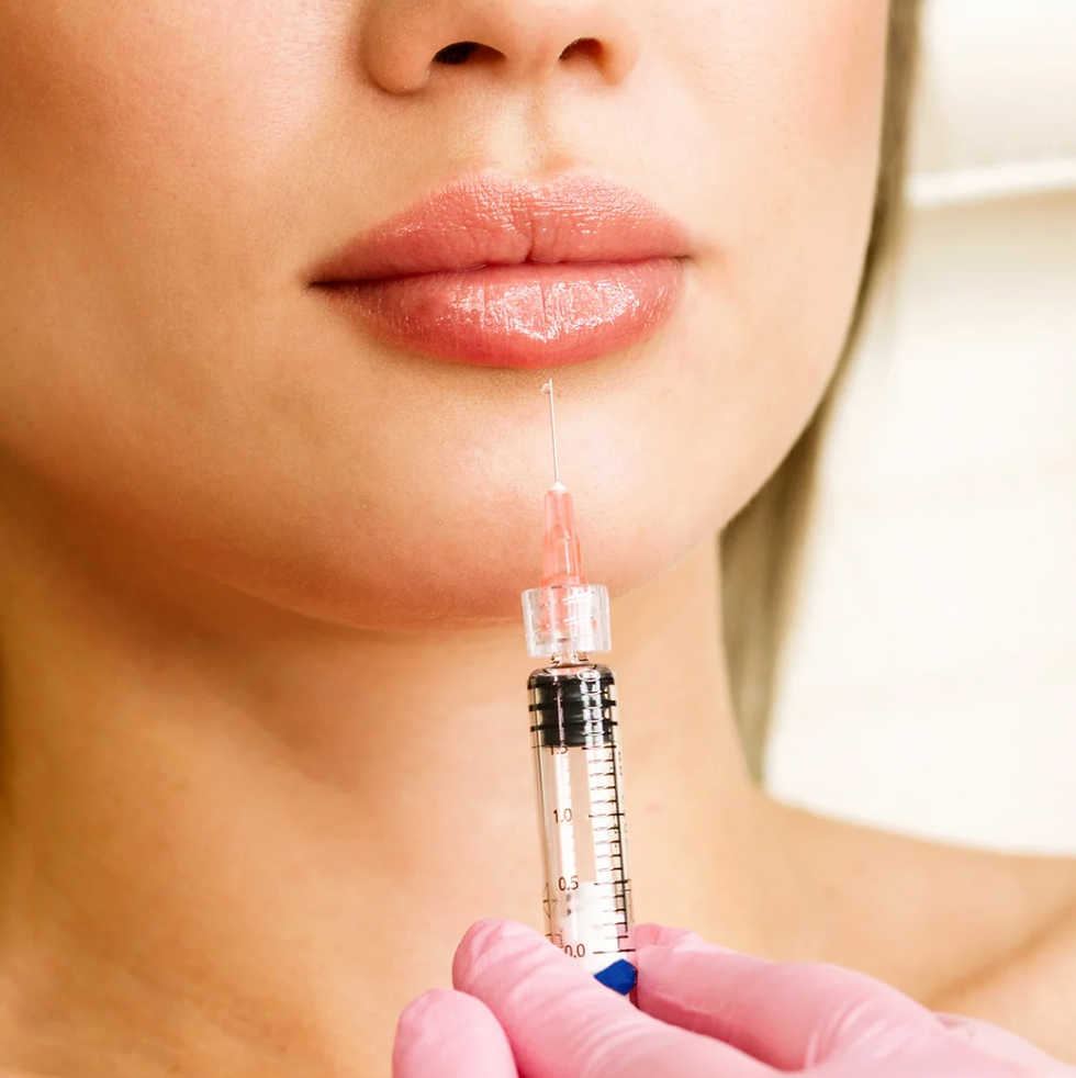 Facial Fillers
