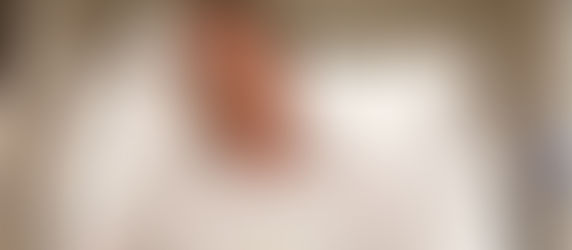 Ex-presidente Jair Bolsonaro tem diagnóstico de câncer de pele inicial, diz médico