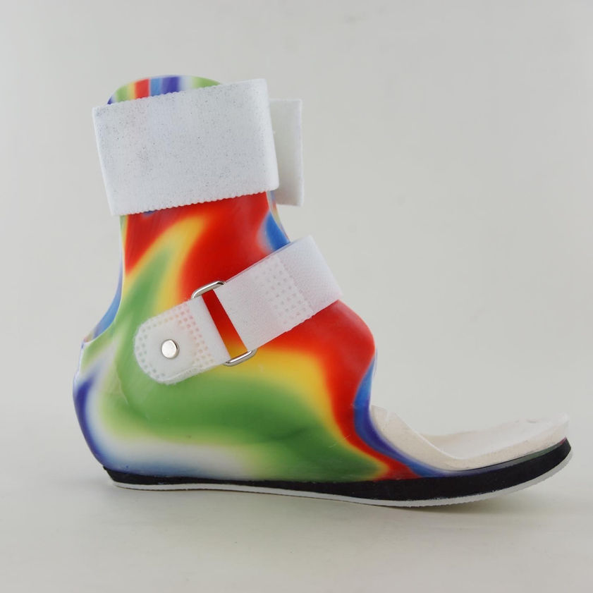 Pediatric Malleolar Orthosis made by intern at Coyote Prosthetics and Orthotics