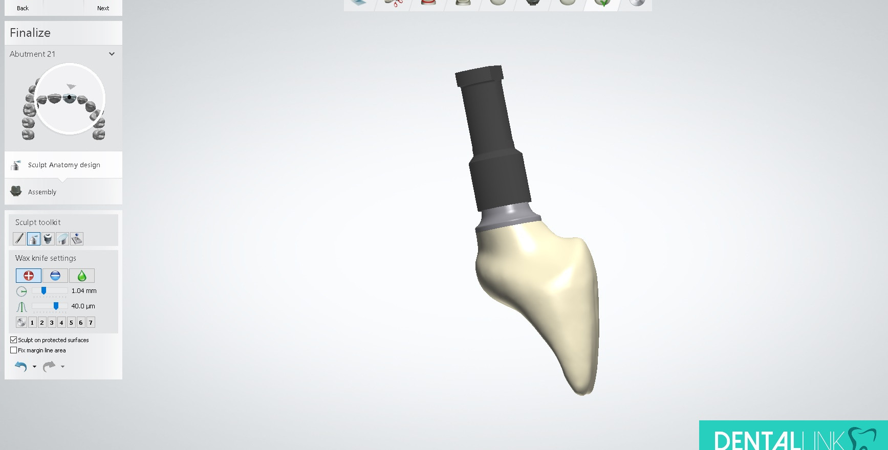 Dental Link immediate temporary implant restoration design 