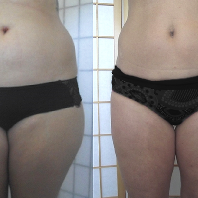 Before After 10.png