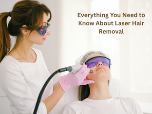 Laser Hair Removal Guide