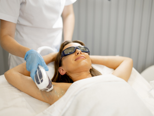 benefits of laser hair removal