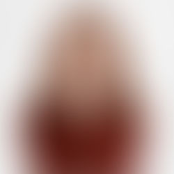 TMJ: causes, symptoms and treatment of temporomandibular dysfunction