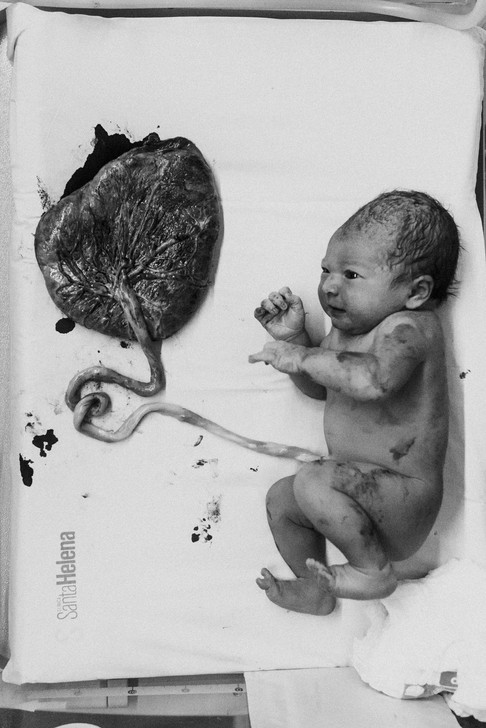 Fotografia e Filmagem do Parto - Registro do nascimento - Parto normal e cesária - Parto na maternidade ou parto domiciliar - Florianópolis e São Paulo - Babuska