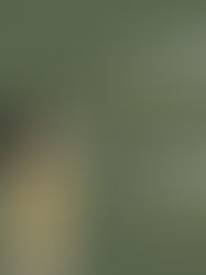 No todas las heridas son visibles…