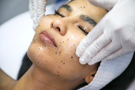 Facial Control Acné