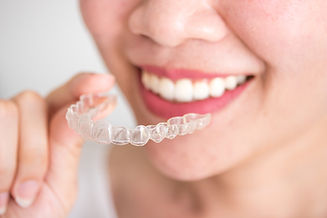 Invisalign Retainer at Orthodontist Fremont Patricia J Sing Choi, DDS.jpeg