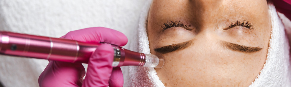 Professional microneedling session to boost collagen and smooth skin texture