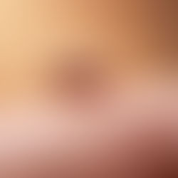 The Ultimate Guide to Bed Bug Prevention: Tips for Homeowners and Tenants