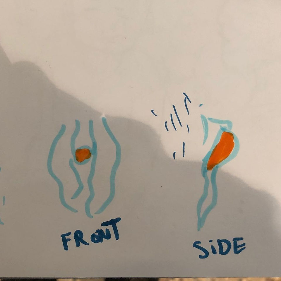Pictures of drawn bottom growth