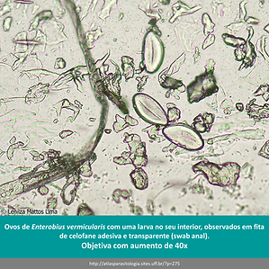 Ovos de Enterobius vermicularis 4.png