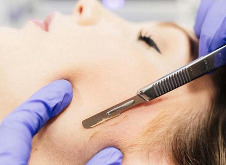 dermaplaning-1.jpg