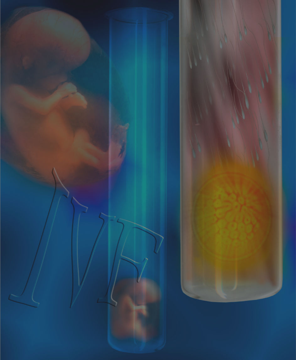 IVF