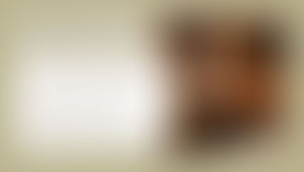 Understanding RF-Related Facial Fat Loss — and How Dynamic Microcurrent Supports Recovery