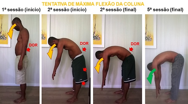 Foto após 5 sessões de osteopatia (H)