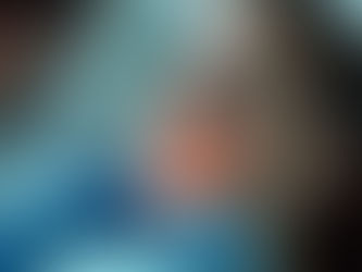 Choose V-Dente for Exceptional Dental Treatments