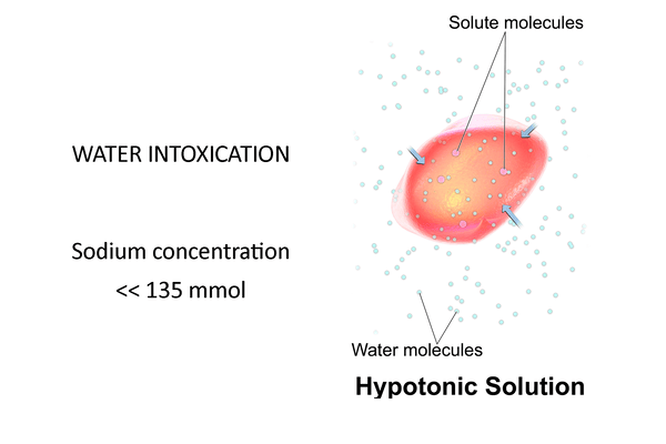 Hypotonic Solution - Water Intoxication