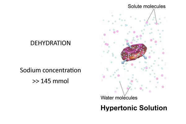 Hypertonic Solution - Dehydration