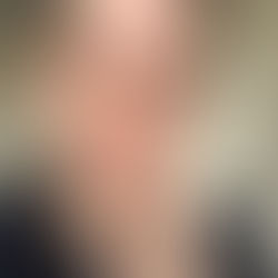 Diabetes cure now hot tips daily