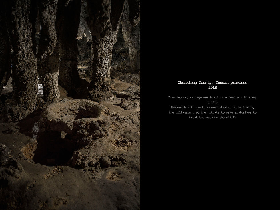 Curse of the Wind. A History of Leprosy in China#19