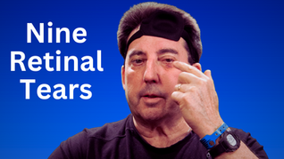 Vitrectomy Surgery to Remove Floaters and Repair Retinal Tears: What It Means for My YouTube Channel