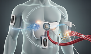 The Artificial Pancreas: How Closed-Loop Systems Are Automating Diabetes Care