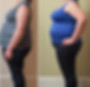 weight loss before and after at MedGalore Aesthetics & Wellness