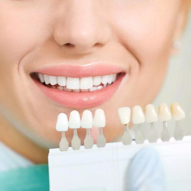 dogwood-dental-medspa-teeth-whitening3-pki3m6tu61s619sb8zben6nmc2gteghwwbcvhd5tts.jpg.webp