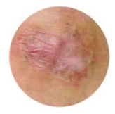 SP_INTL_TreatmentTrainerTools_Full-binder_A4_APPROVED-1_Page_7_Image_0007.jpg
