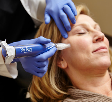 Procedure in process