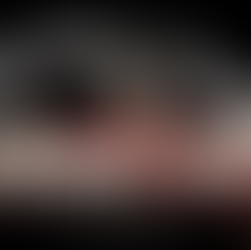 Doğal Diş mi ? İmplant mı ?