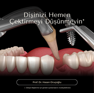 Doğal Diş mi ? İmplant mı ?