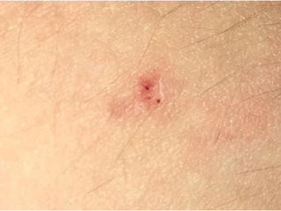 Wolverhampton / Isles Of Scilly Contact Case