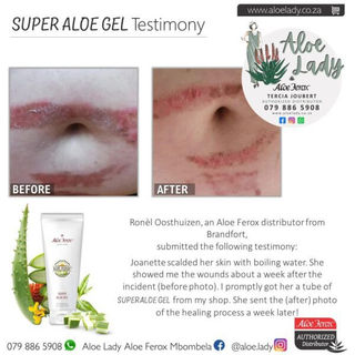 aleo aloe vera gel Original Aloe Vera Jelly with Allantoin  sascoproducts
