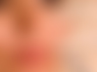 Medikal Botoks - Masseter Botoks